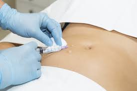 Carboxiterapia para celulitis y remodelación corporal en Clínica Alicia Forcada